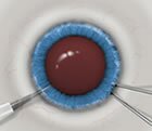 icl2_med