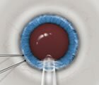 icl3_med